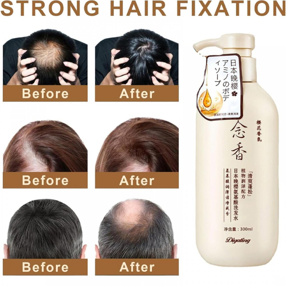 Sakura Japanese Shampoo and Conditioner Set for Hair Loss Prevention - 300ml