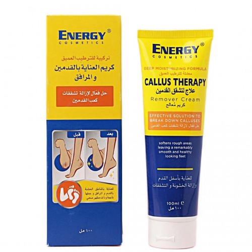 Energy Cosmetics Callus Remover Cream Sj | 100 Ml
