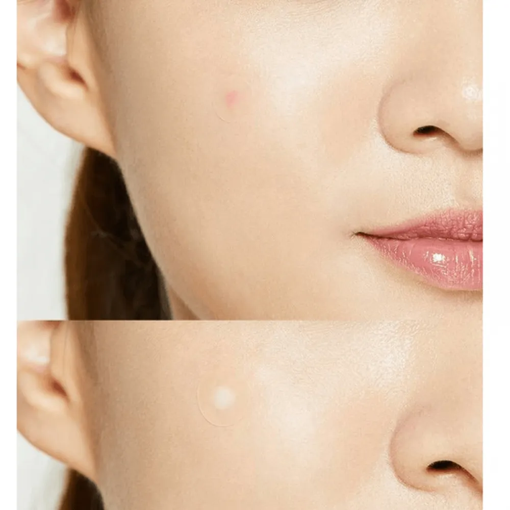 Cosrx Acne Pimple Master Patch - 24 Patches