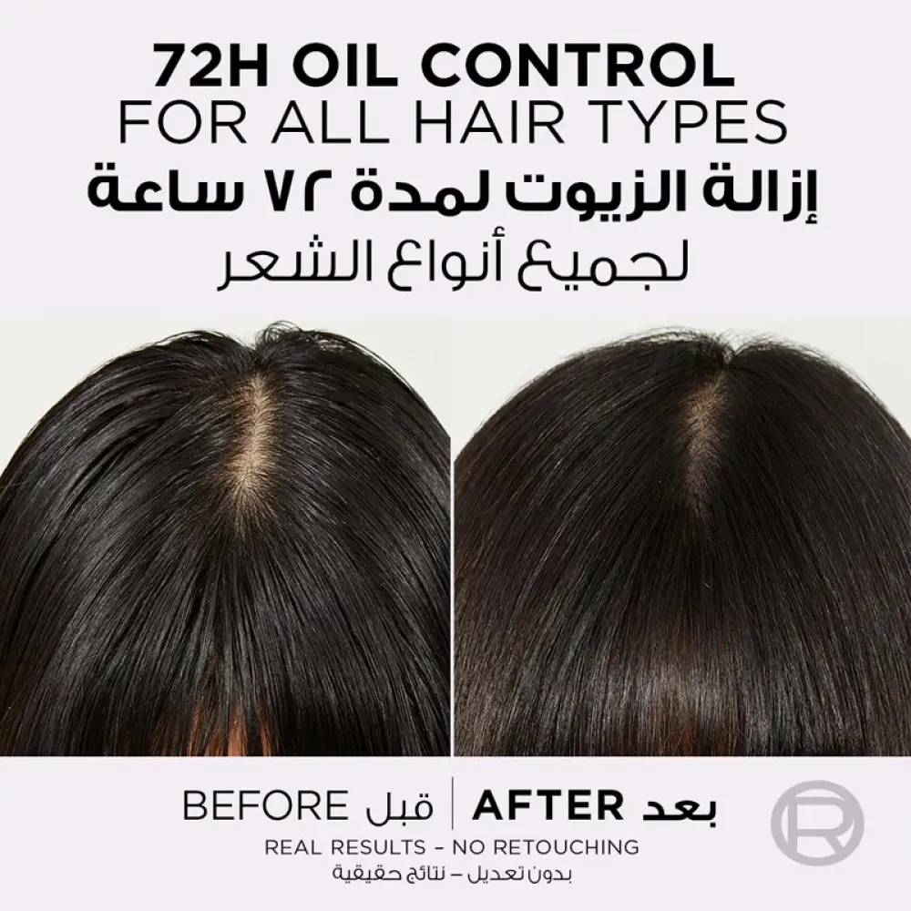 Elvive Scalp Serum Hyaluron Pure Oil Erasing 102ml