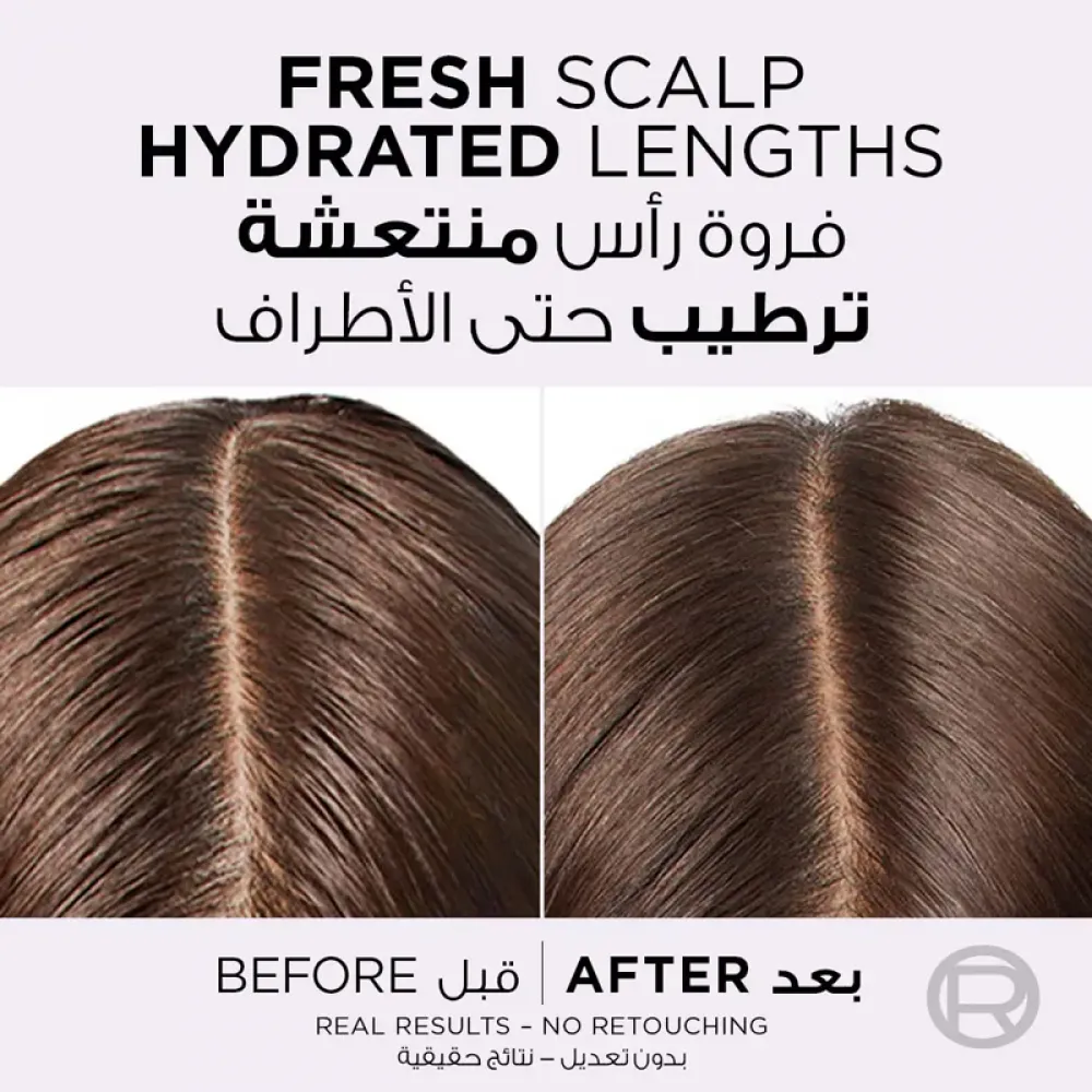 Elvive Scalp Serum Hyaluron Pure Oil Erasing 102ml