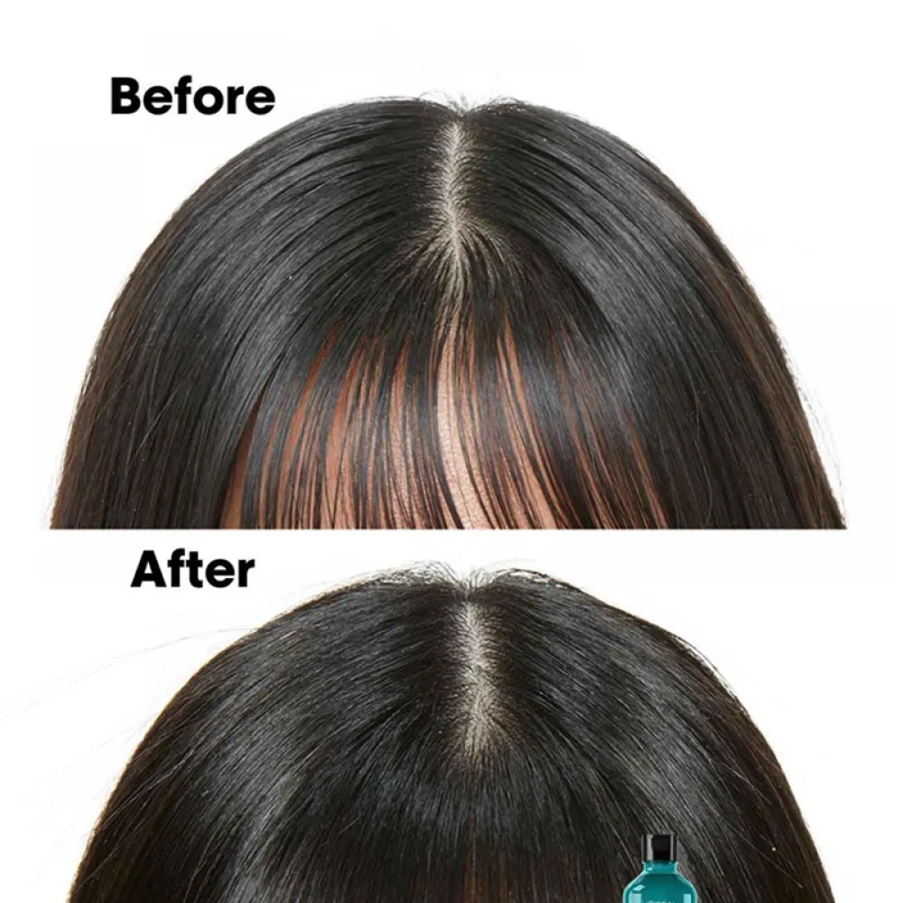 L'Oréal Professionnel Scalp Advanced Anti-Oiliness Shampoo 300ml