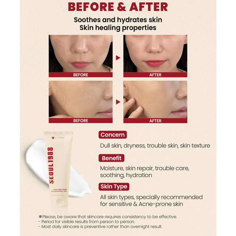 كي سيكرت سيول 1988 كريم بخلاصة موسين الحلزون 93% + أرز - 100 مل