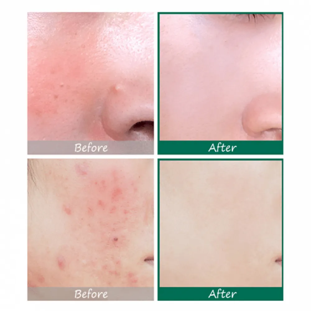 Some By Mi AHA. BHA. PHA 30 Days Miracle Serum- 50ml