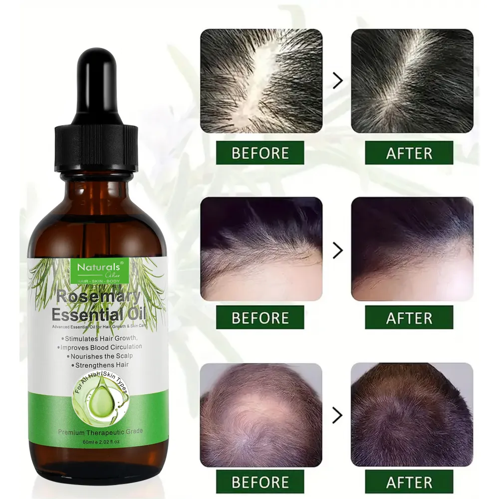 Natural Cibee Rosemary Oil for Hair Growth, Rosemary Essential Oil Nourishes Scalp, Strengthens Hair and Stimulates Hair Growth for Women and Men 60 mil