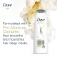Dove Shampoo Anti Dandruff 400 ml