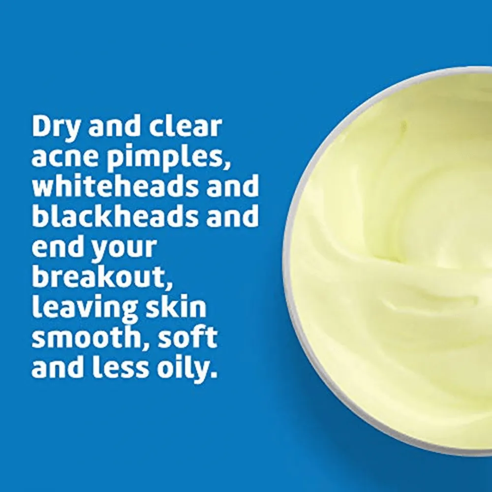 De La Cruz Acne Treatment with 10% Sulfur - 73.7g