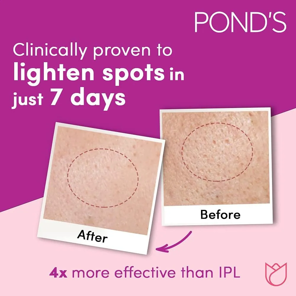 POND'S Flawless Radiance Moisturizing Day Cream with SPF 30 and Niacinamide Even-tone Glow fades dark marks 50g