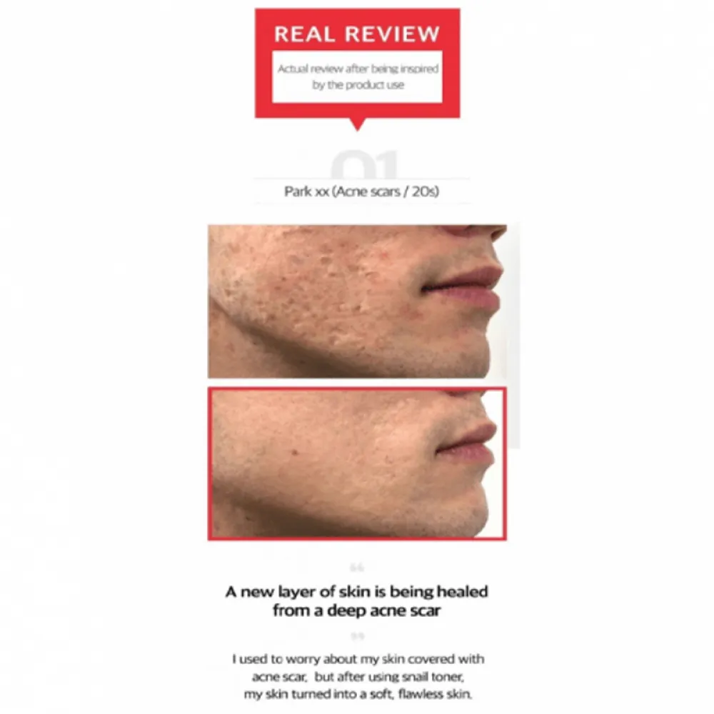 Some By Mi Snail Truecica Miracle Repair Starter Kit - 4 Pieces