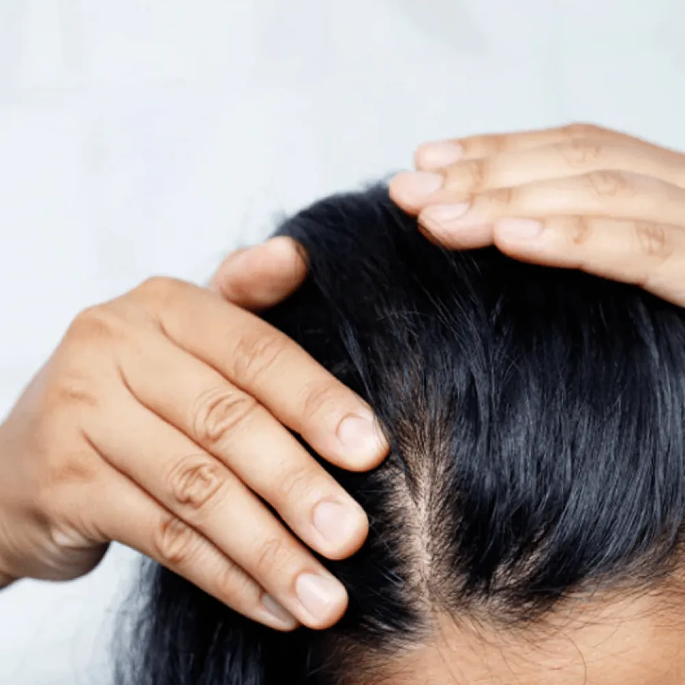 ACM Novophane.K Shampooing Antipelliculair Anti-Dandruff Shampoo - 125ml